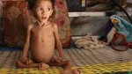 منحة بقيمة 19.8 مليون يورو لليونيسف في اليمن لمكافحة الأزمة التغذوية