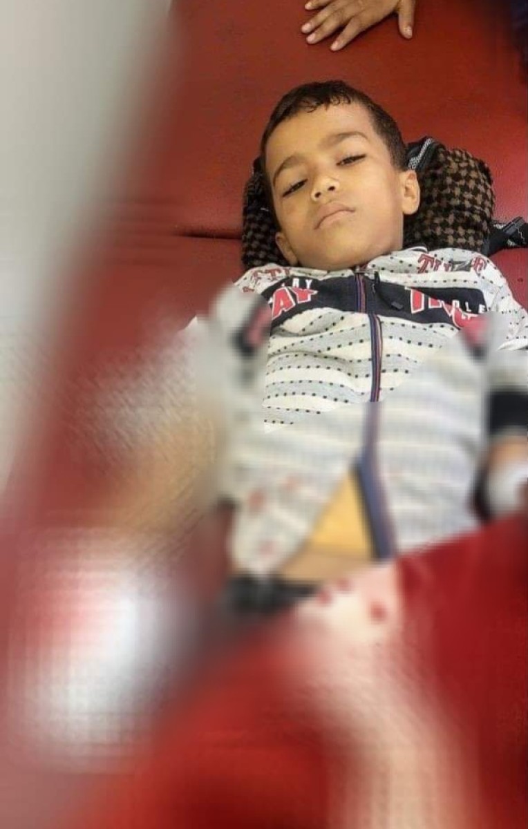 A child was injured by a Houthi sniper in Taiz