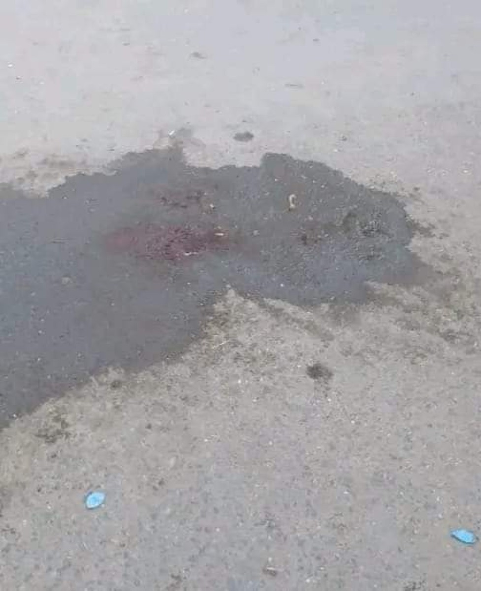 The first photo of the scene of the crime scene in which a twenty-year-old student was stabbed in Aden