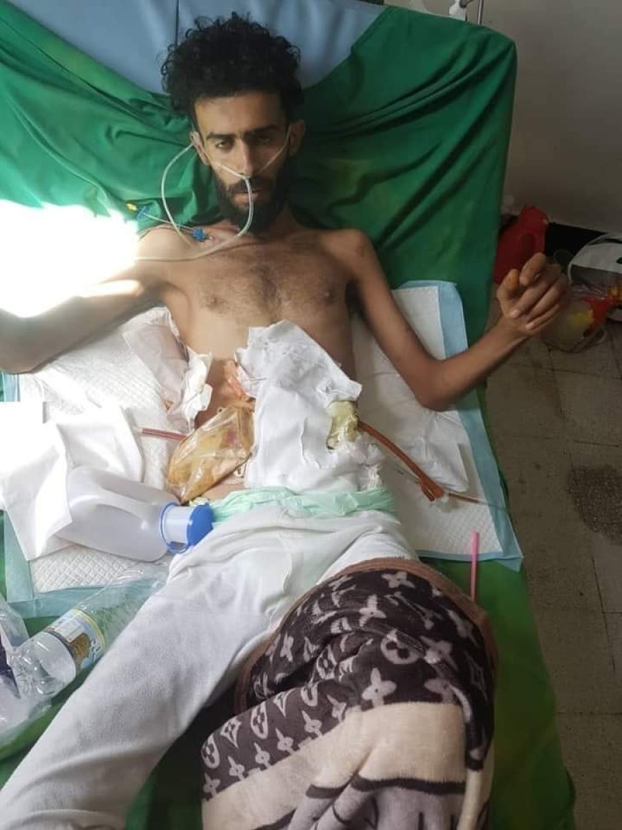 The war did not kill him.. The Taiz Special Tasks Battalion killed him!