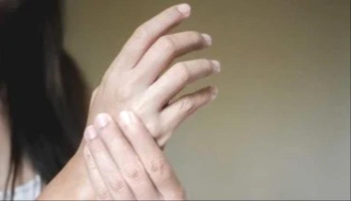 Hand arthritis: symptoms you should pay attention to and ways to reduce pain