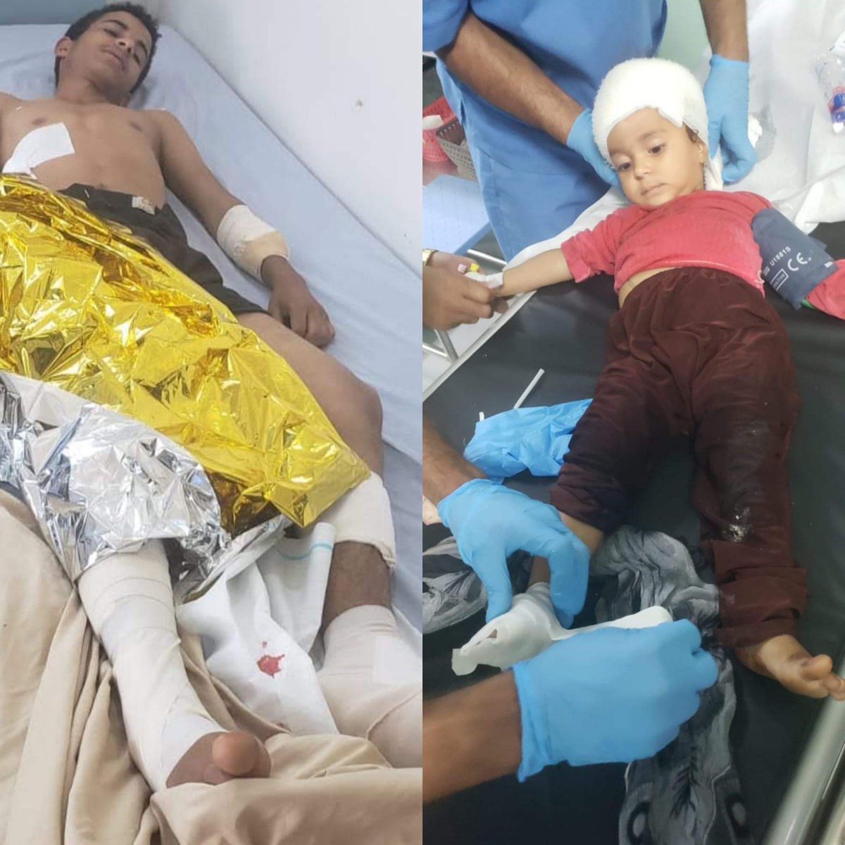 A Houthi projectile injured 3 children from one family, north of Al Dhalea