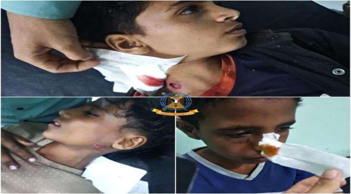 A Houthi projectile exploded in 3 children north of Al-Dhalea