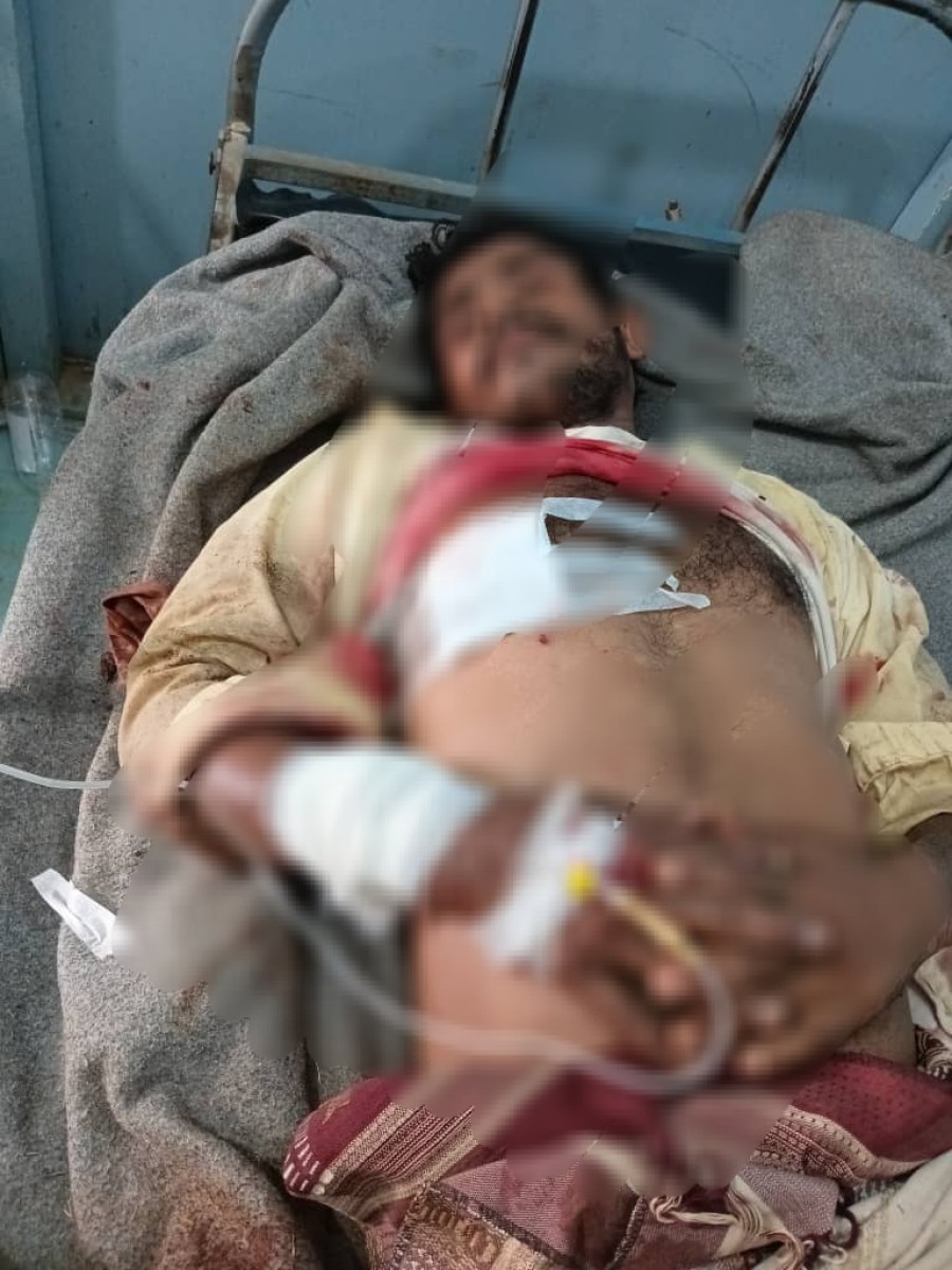 Three citizens, including a woman, were injured in a Houthi mine explosion northwest of Hais