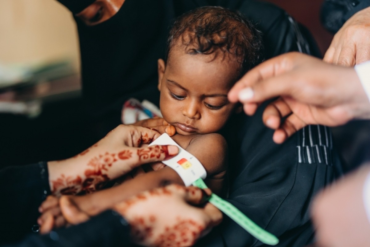 2.3 million children and women in Yemen were deprived of malnutrition treatment in September due to lack of funding