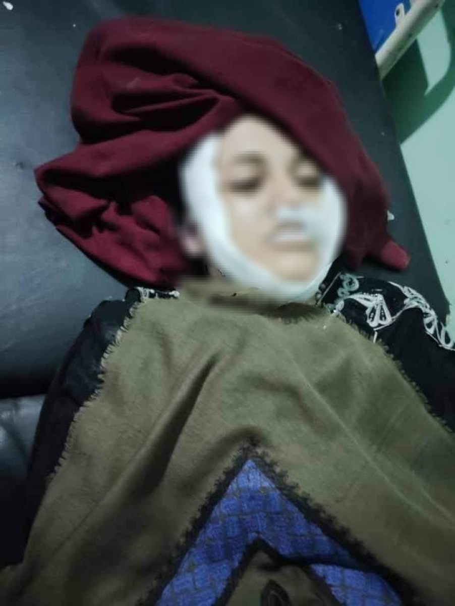 Taiz.. A girl was killed by a “poisoned needle” because she refused to marry