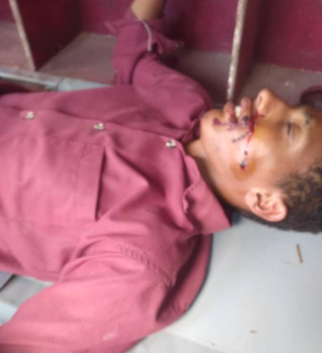 A child was injured by a Houthi sniper in Karsh, Lahj