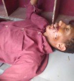 A child was injured by a Houthi sniper in Karsh, Lahj